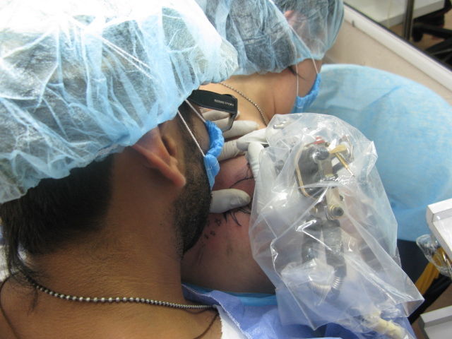 Bioseguridad aplicada al tatuaje corporal
